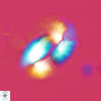 Helicosphaera princei VR 03629