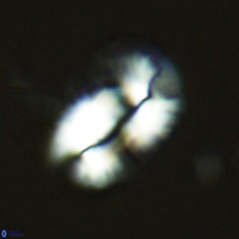 Helicosphaera princei VR 03631