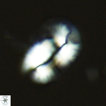 Helicosphaera princei VR 03631