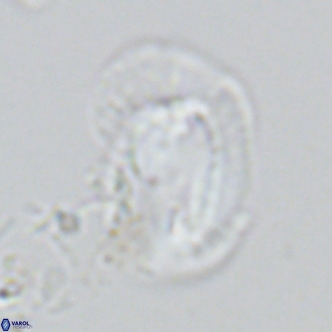 Helicosphaera princei VR 03633