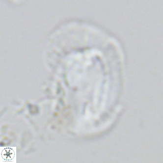 Helicosphaera princei VR 03633