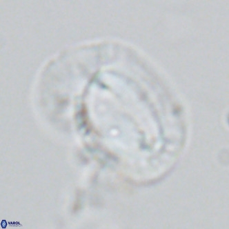 Helicosphaera princei VR 03635