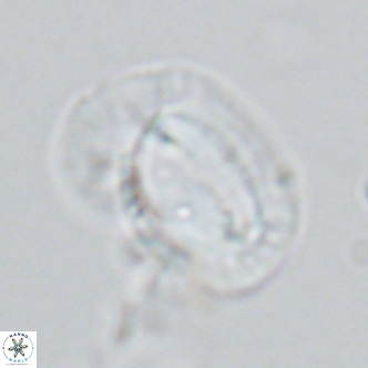 Helicosphaera princei VR 03635