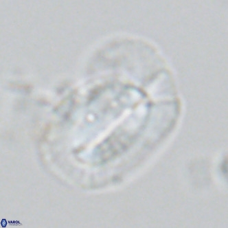 Helicosphaera princei VR 03636