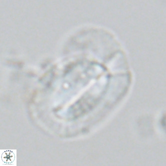Helicosphaera princei VR 03636