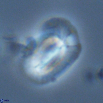 Helicosphaera princei VR 03637