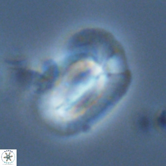 Helicosphaera princei VR 03637