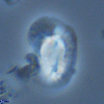 Helicosphaera princei VR 03638