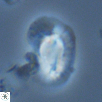 Helicosphaera princei VR 03638