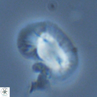 Helicosphaera princei VR 03639