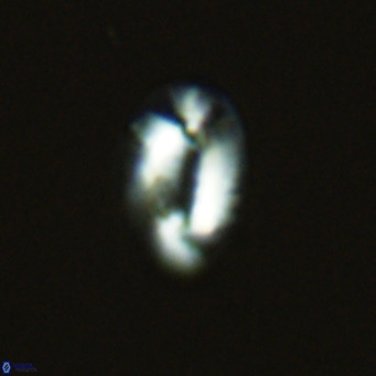 Helicosphaera princei VR 04643