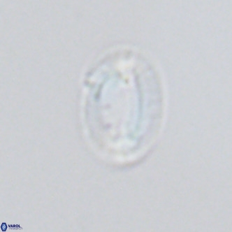 Helicosphaera princei VR 04648