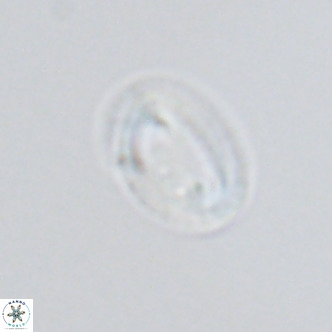 Helicosphaera princei VR 04650
