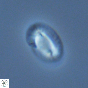 Helicosphaera princei VR 04651