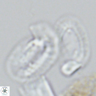 Helicosphaera princei neogranulata VR 03796
