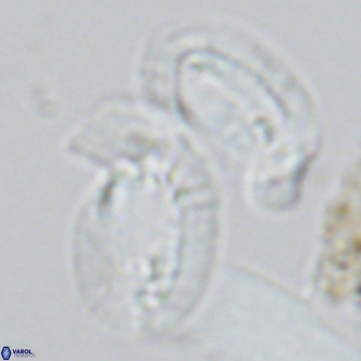 Helicosphaera princei neogranulata VR 03797