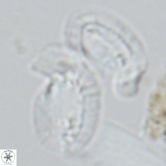 Helicosphaera princei neogranulata VR 03797