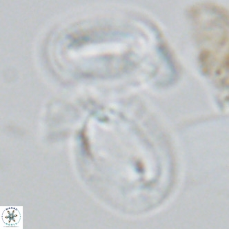 Helicosphaera princei neogranulata VR 03798