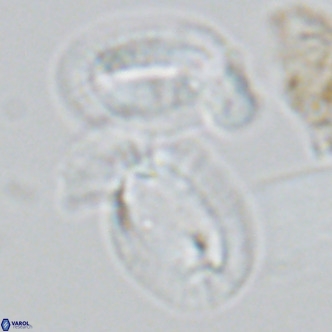 Helicosphaera princei neogranulata VR 03799
