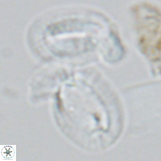 Helicosphaera princei neogranulata VR 03799