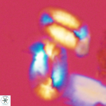 Helicosphaera princei neogranulata VR 03791