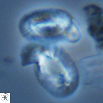 Helicosphaera princei neogranulata VR 03800