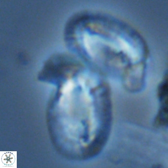 Helicosphaera princei neogranulata VR 03801