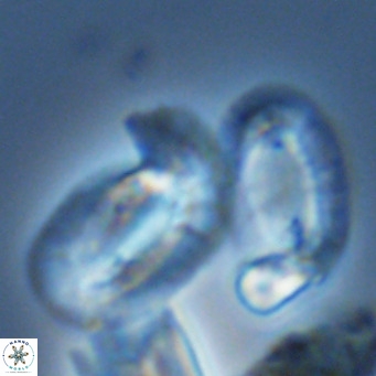 Helicosphaera princei neogranulata VR 03802