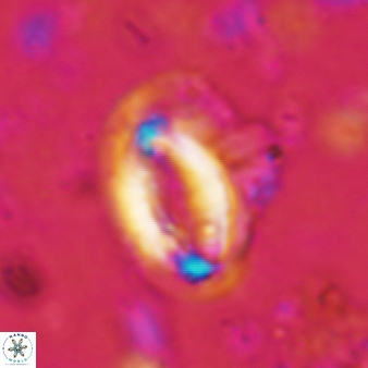 Helicosphaera scissura 340