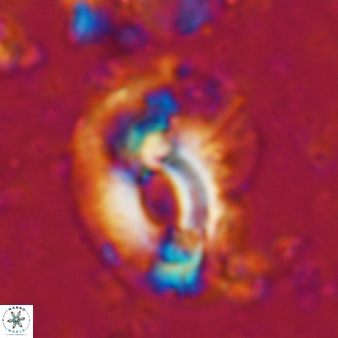 Helicosphaera scissura 342