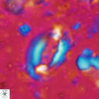 Helicosphaera scissura 344