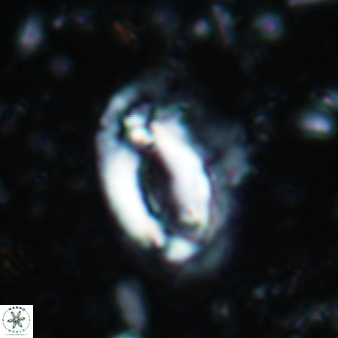 Helicosphaera scissura 339