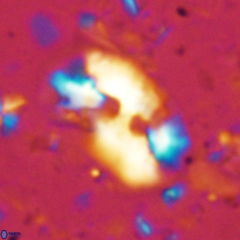 Helicosphaera sellii VR 07913