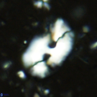 Helicosphaera sellii VR 07918