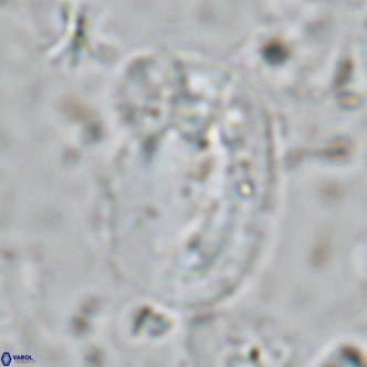 Helicosphaera sellii VR 07921