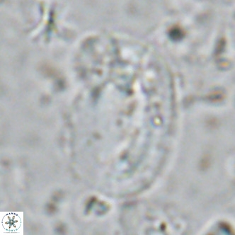 Helicosphaera sellii VR 07921