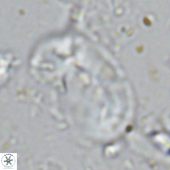 Helicosphaera sellii VR 07922
