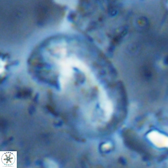 Helicosphaera sellii VR 07924