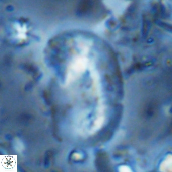 Helicosphaera sellii VR 07925