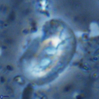 Helicosphaera sellii VR 07926