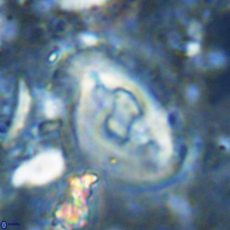 Helicosphaera seminulum 49140
