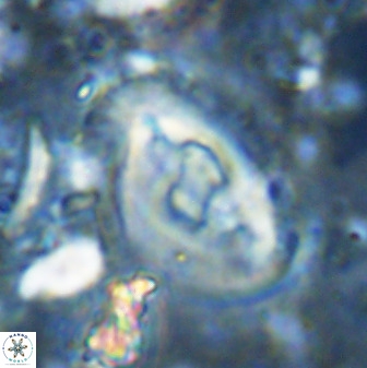 Helicosphaera seminulum 49140