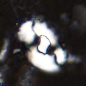 Helicosphaera seminulum 49131
