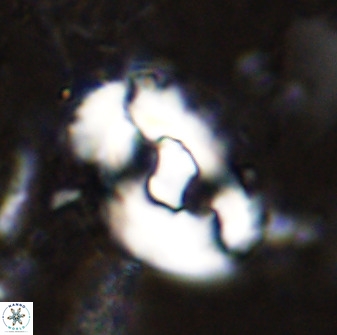 Helicosphaera seminulum 49131
