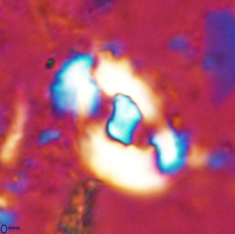 Helicosphaera seminulum 49132