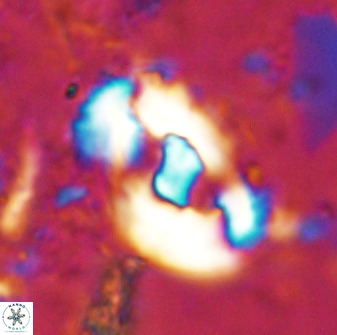 Helicosphaera seminulum 49132