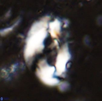 Helicosphaera seminulum 49133