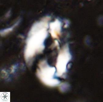 Helicosphaera seminulum 49133