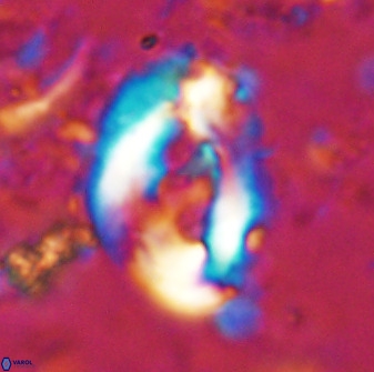 Helicosphaera seminulum 49134