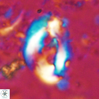 Helicosphaera seminulum 49134